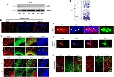 iASPP regulates neurite development by interacting with Spectrin proteins